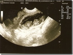 13-03-05-ultraschallbild